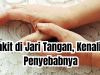 penyebab sakit di jari tangan