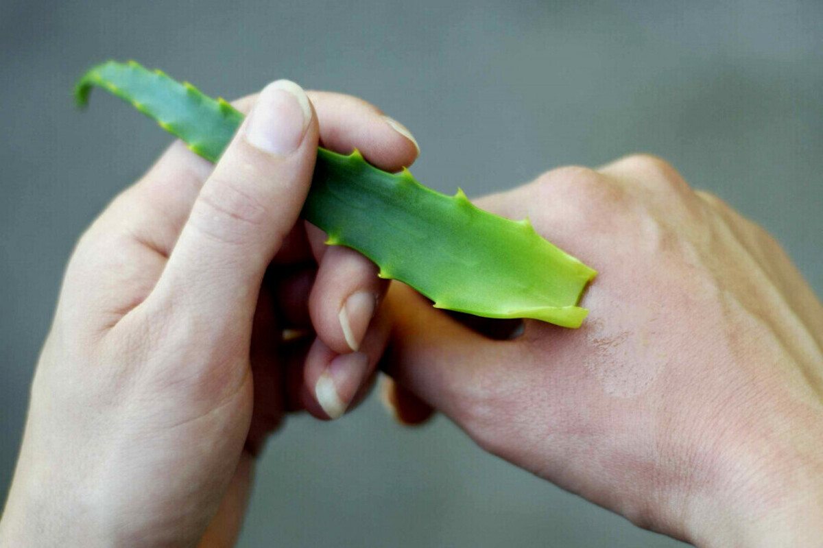 Cara mempercepat penyembuhan luka menggunakan lidah buaya.