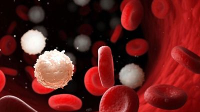 Artikel kali ini sangat penting untuk diperhatikan karena membahas tentang jenis-jenis kanker dan juga penyebabnya.